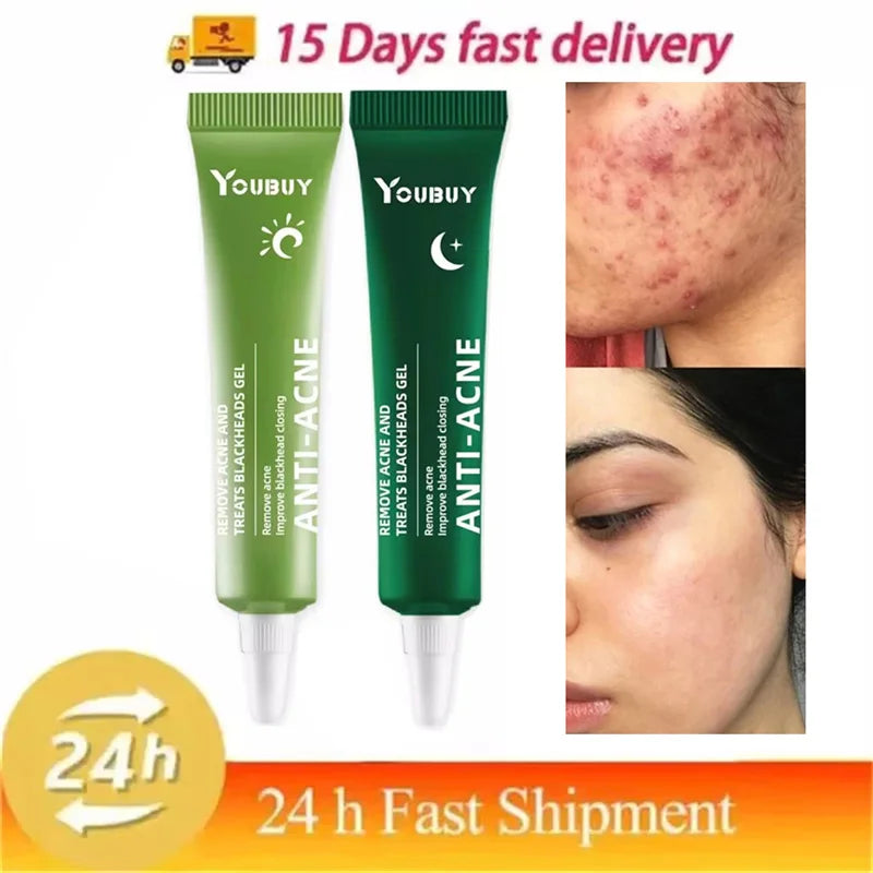 S1c9d1ec64c0b44b6b2fb30a5b05107fez