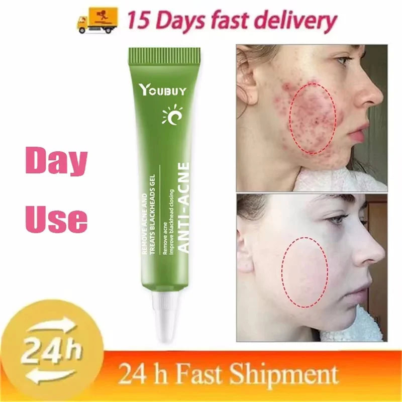 S68b159d14d134700a0c6d46e431f46fcC